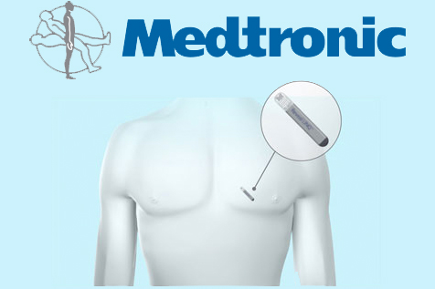 Medtronic touts real-world study of Reveal Linq monitor
