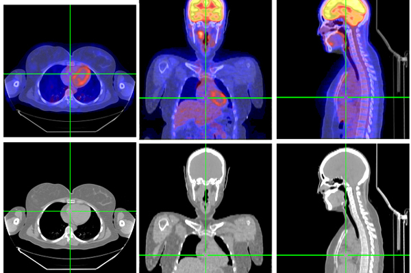 High-tech imaging behind overkill surgery, Mayo Clinic says