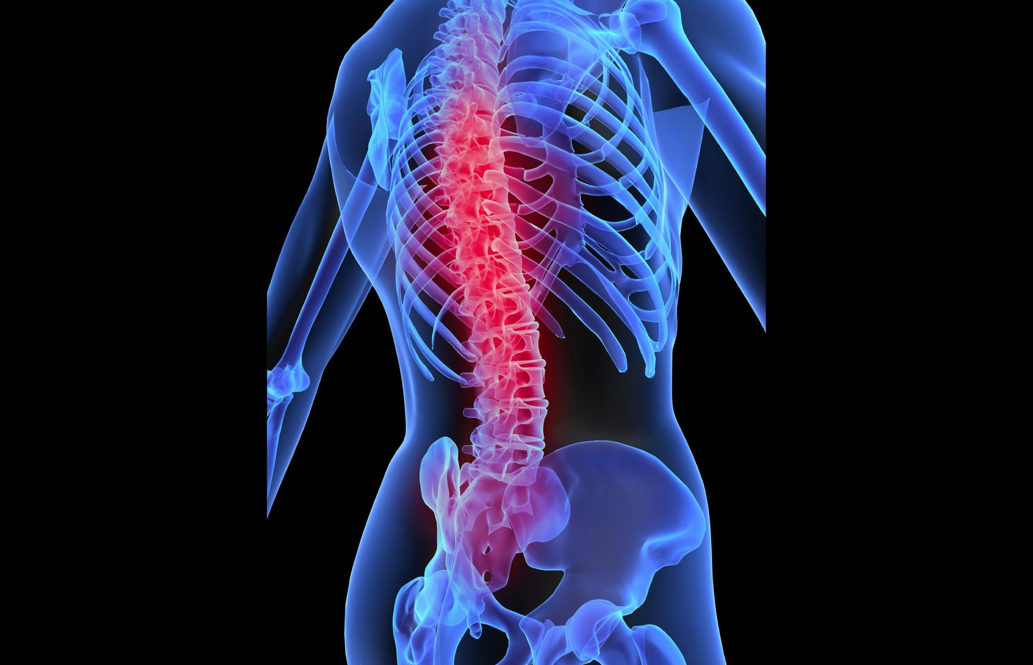 Can 2nd-tier spinal companies grow in a challenging sector?