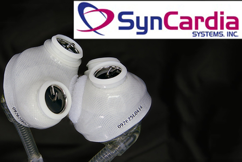 Syncardia lands key FDA win for its Total Artificial Heart