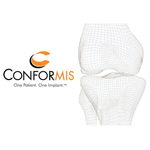 ConforMIS touts knee replacement study data