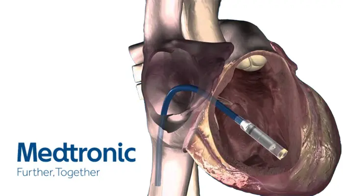 Medtronic's Micra leadless pacemaker