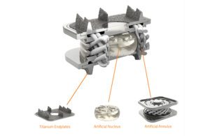Orthofix Medical cutaway image of M6-C artificial cervical disc with its mimicry of a natural disc