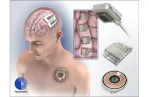 Paradromics Connexus direct data interface DDI brain-computer interface BCI