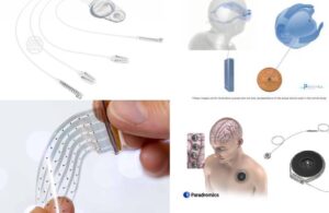 5 More Brain-Computer Interface BCI companies you should know 2024 (1)