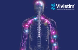MicroTransponder Vivistim MOA Illustration + Logo